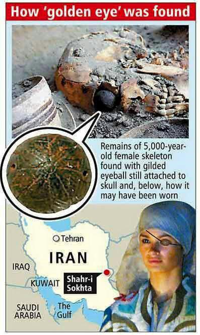  چشم مصنوعی 5000 ساله شهر سوخته ایران که متعلق به زنی 25 تا 30 ساله بوده است 